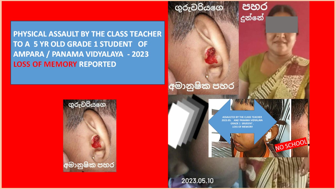 CHILD ABUSE – PHYSICAL ASSAULT BY CLASS TEACHER TO A 5 YR OLD GRADE 1 STUDENT. LOSS OF MEMORY REPORTED