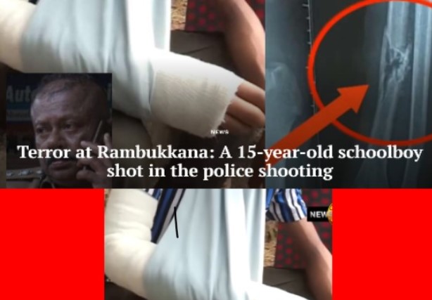 A 15-YEAR-OLD SCHOOLBOY SHOT IN THE POLICE SHOOTING-RAMBUKKANA EXPOSED BY UHRO